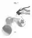 Fig. 02 - Image reconstruction by position and motion tracking