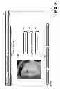 Fig. 11 - SYSTEMS, DEVICES, AND METHODS FOR IMAGE ANALYSIS