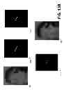 Fig. 17 - SYSTEMS, DEVICES, AND METHODS FOR IMAGE ANALYSIS