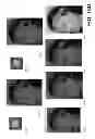 Fig. 19 - SYSTEMS, DEVICES, AND METHODS FOR IMAGE ANALYSIS