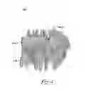 Fig. 07 - Virtual cephalometric imaging