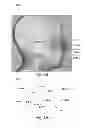 Fig. 08 - Virtual cephalometric imaging