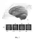 Fig. 03 - Method and system for processing multiple series of biological images obtained from a patient