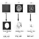 Fig. 06 - Method and system for processing multiple series of biological images obtained from a patient