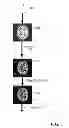 Fig. 07 - Method and system for processing multiple series of biological images obtained from a patient