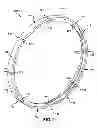 Fig. 02 - Rotary machine seal assembly with butt gap seal elements