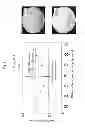 Fig. 02 - METHOD OF MANUFACTURING EYEGLASS LENS