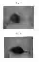 Fig. 04 - METHOD FOR PREPARING ES CELLS