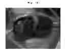 Fig. 08 - METHOD FOR PREPARING ES CELLS
