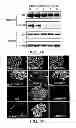 Fig. 05 - Identification of a Genetic Risk Factor for Diabetes