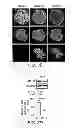 Fig. 06 - Identification of a Genetic Risk Factor for Diabetes