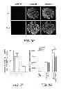 Fig. 07 - Identification of a Genetic Risk Factor for Diabetes