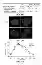 Fig. 13 - Identification of a Genetic Risk Factor for Diabetes