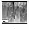 Fig. 16 - Compositions and methods for cancer detection and treatment