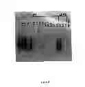 Fig. 06 - Synthesis of long-chain polyunsaturated fatty acids by recombinant cell