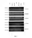 Fig. 11 - Synthesis of long-chain polyunsaturated fatty acids by recombinant cell