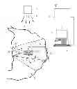 Fig. 02 - Method, device and endoscopy capsule to detect information about the three-dimensional structure of the inner surface of a body cavity