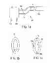 Fig. 02 - Endoluminal and transluminal surgical methods and devices