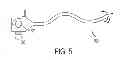 Fig. 06 - Endoluminal and transluminal surgical methods and devices