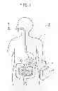Fig. 02 - CAPSULE MEDICAL DEVICE