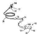 Fig. 01 - Technique for remanufacturing a medical sensor