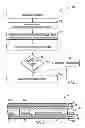 Fig. 07 - Technique for remanufacturing a medical sensor