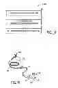 Fig. 09 - Technique for remanufacturing a medical sensor