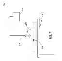 Fig. 08 - CZT SENSOR FOR TUMOR DETECTION AND TREATMENT