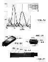 Fig. 09 - Ultrasonic transducer assembly