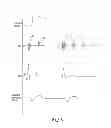 Fig. 02 - Pulse detection using patient physiological signals