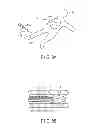 Fig. 09 - Medical apparatus
