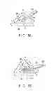 Fig. 11 - Medical apparatus