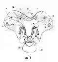 Fig. 02 - Cervical collar with cable reel adjustment system