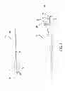 Fig. 02 - Thrombectomy catheter with aspiration and guidewire lumens defining an asymmetrical taper and cutting edge with offset tip