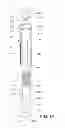 Fig. 02 - Automatic reconstitution for dual chamber syringe