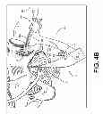 Fig. 09 - Multi-arm tool for delivering implants and methods thereof