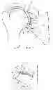 Fig. 02 - Bone anchor having an integrated stress isolator
