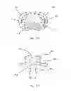Fig. 09 - Multilayer One-Piece Pacifier