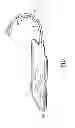 Fig. 02 - SURGICAL LEAD PADDLE