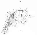 Fig. 01 - Glenoidal component, set of such components and shoulder prosthesis incorporating such a glenoidal component