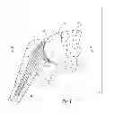Fig. 02 - Glenoidal component, set of such components and shoulder prosthesis incorporating such a glenoidal component