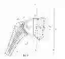 Fig. 03 - Glenoidal component, set of such components and shoulder prosthesis incorporating such a glenoidal component