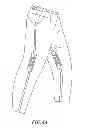 Fig. 05 - LOOP BASED STABILIZATION AND SUPPORT FOR PROTECTIVE ACCESSORY