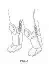 Fig. 07 - LOOP BASED STABILIZATION AND SUPPORT FOR PROTECTIVE ACCESSORY