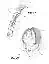 Fig. 13 - Form-fitting protective headwear
