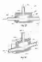 Fig. 34 - Method and system for controlling drippings from a beverage dispenser via an expansion valve