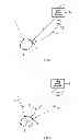 Fig. 02 - Methods for operating a hearing device as well as hearing devices