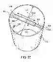 Fig. 28 - Tank dampening device