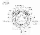 Fig. 03 - Electric compressor with the stator coils coated with resin, the resin having openings exposing the coils to the interior of the housing