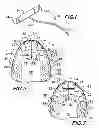 Fig. 02 - Palatal t-bar
